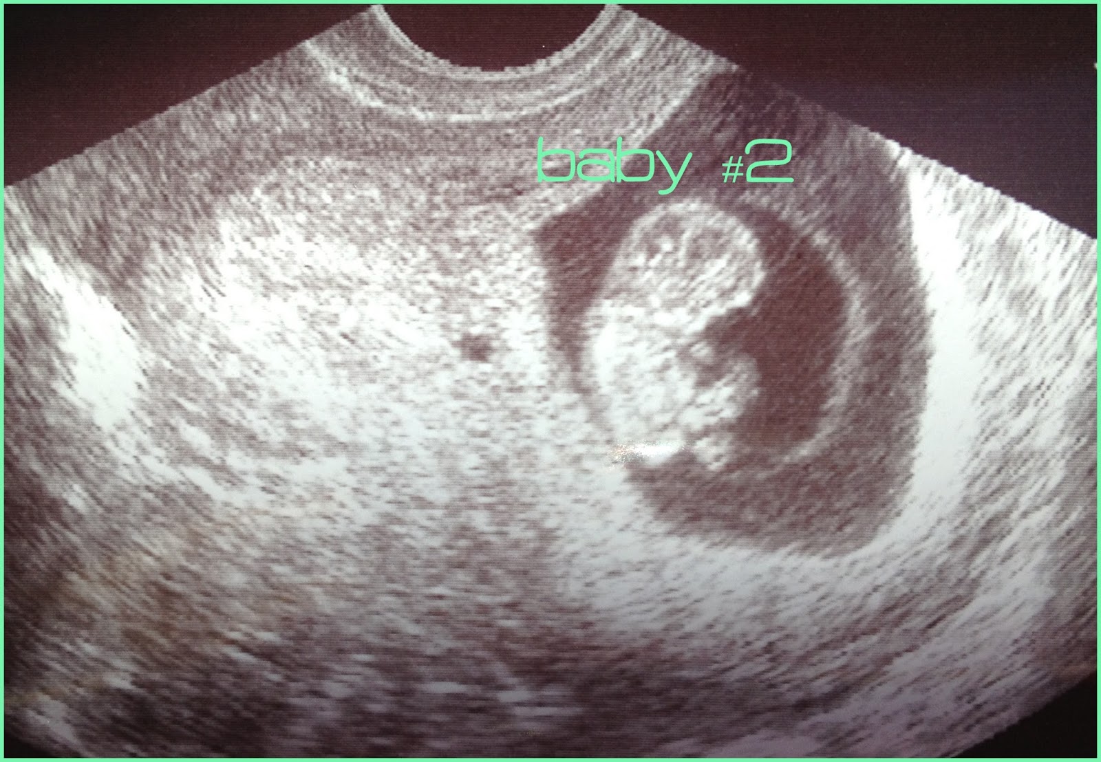 Baby's gender revealed at 13 weeks. 