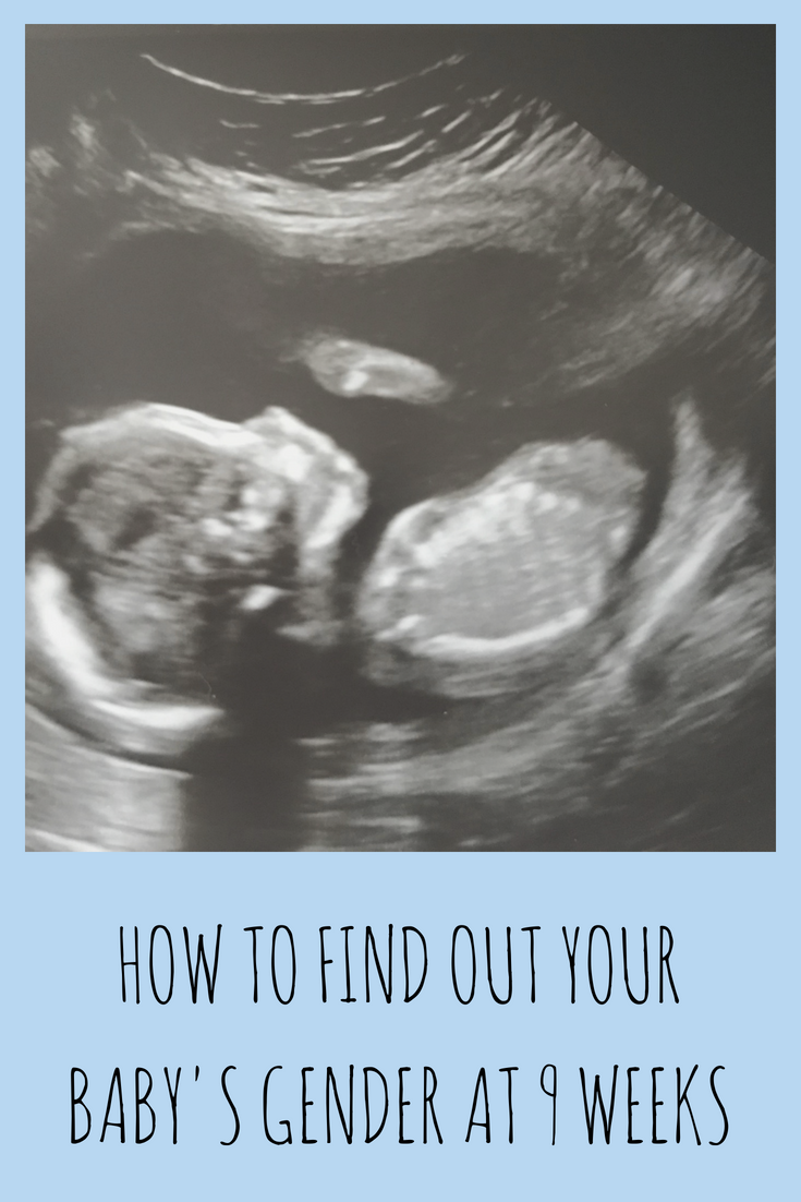 how to tell the gender of your baby